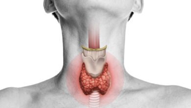 Thyroidectomy