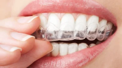 Invisalign Aberdeen