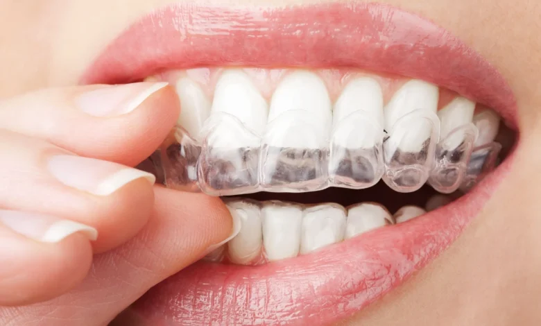 Invisalign Aberdeen