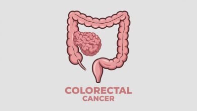 Colorectal Surgeon in Los Angeles