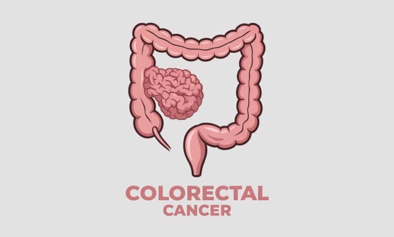 Colorectal Surgeon in Los Angeles