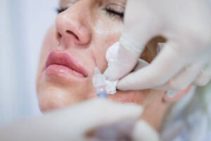 PRP Treatment: The Natural Path to Skin Healing