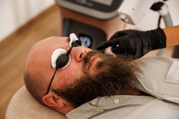 Permanent Hair Removal Solutions for Men