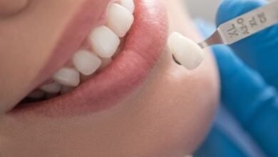 How Composite Veneers Can Fix Gaps and Discolored Teeth