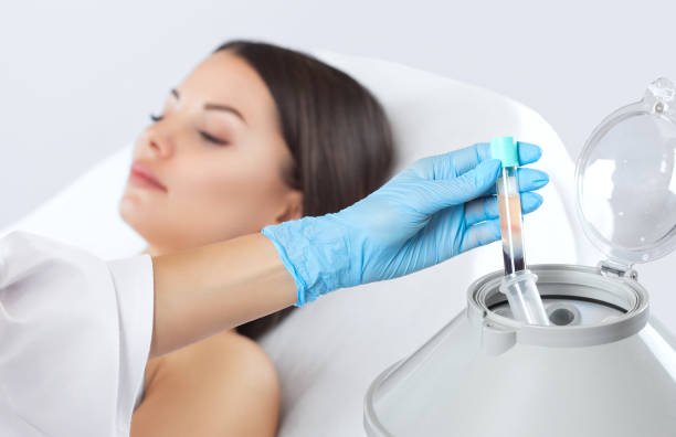 PRP Hair Treatment Cost in Abu Dhabi