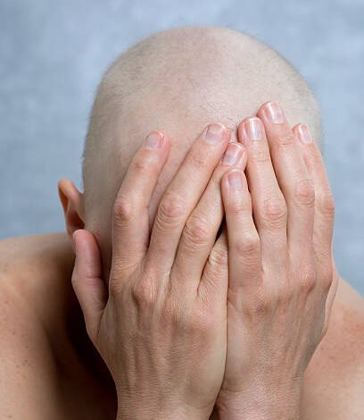 Hair Loss & Nail Disorders in Abu Dhabi