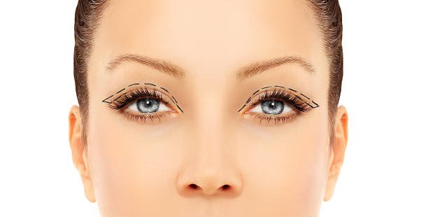 Eyelid surgery in Abu Dhabi