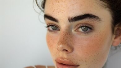 A Closer Look at Melasma Treatment