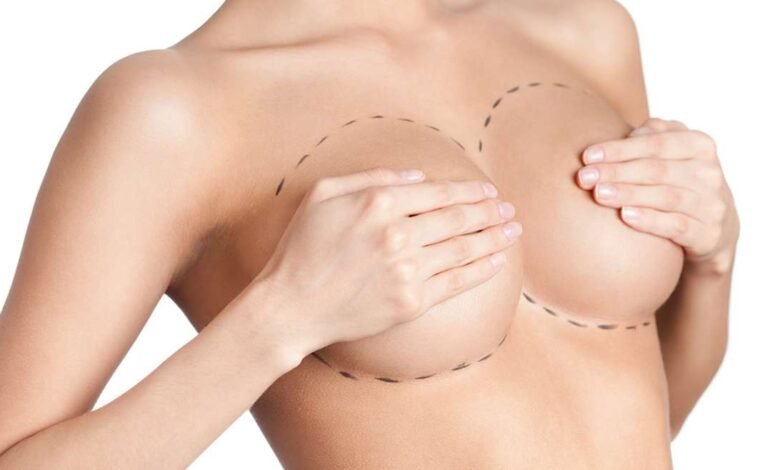 How to Prepare Mentally and Physically for Breast Augmentation in Dubai