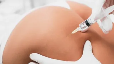 Best Aesthetics Clinic in Dubai Top Reasons to Choose Butt Fillers Over Implants