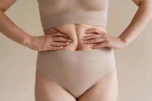 How to Prepare for a Mini Tummy Tuck 