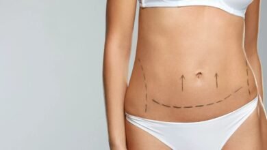 Best Liposuction Surgeons in Dubai Cost Considerations and What to Expect