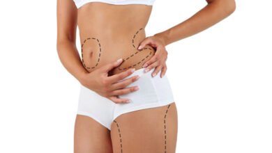 Liposuction in Islamabad