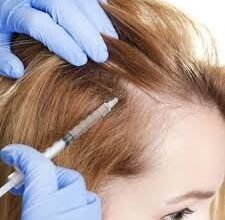 PRP Hair Injection in Dubai