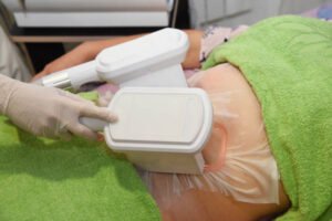 The Impact of Non-Invasive Fat Removal 