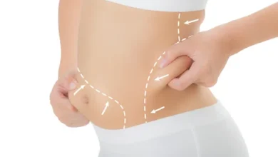 The Benefits of Liposuction In Dubai Beyond Just Aesthetics