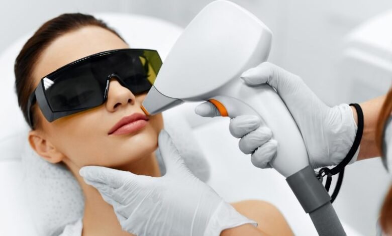 laser hair removal