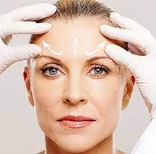 A New Era of Surgery: Brow Lift Surgery 