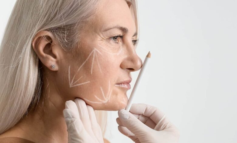 Common Myths About Facelifts