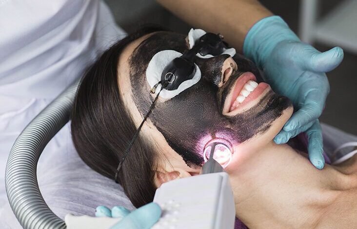 Common Myths About Spectra Laser Carbon Peel