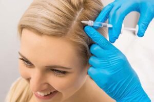 How to Prepare for PRP Hair Treatment 