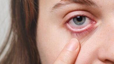 How to Spot the Symptoms of Common Eye Infections