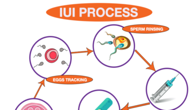 IUI Treatment