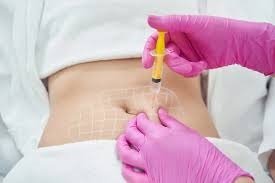 Lipolysis Injections in Dubai