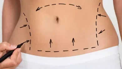 The Importance of a Comprehensive Consultation with the Best Doctors for Liposuction in Dubai