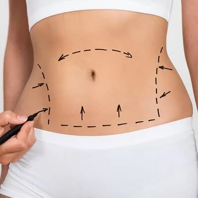 The Importance of a Comprehensive Consultation with the Best Doctors for Liposuction in Dubai