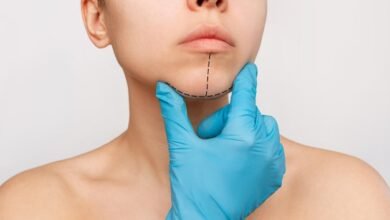 Post-Procedure Care for Buccal Fat Removal