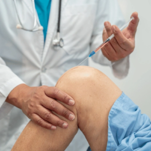 Steps to Recovery After PRP Knee Injections