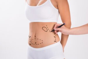 Uncovering the Secrets of Liposuction in Abu Dhabi