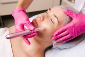 What is Microneedling and How Does It Work?