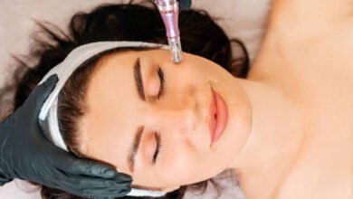 What is Microneedling and How Does It Work?