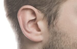 What is the Ear Reshaping Procedure ?