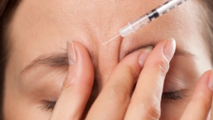 Who Can Benefit from Botox Treatment?