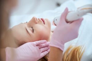 Improve Skin Texture with Microneedling for Acne Scars 