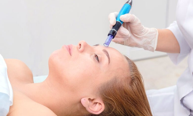 Preparing for Your Mesotherapy Session