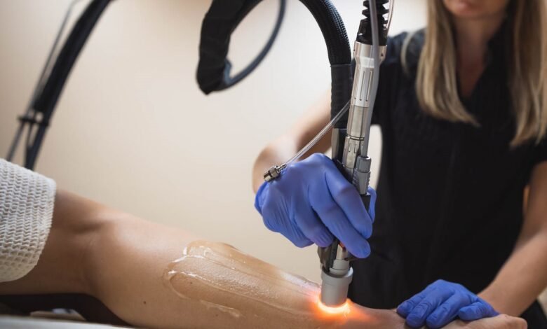 Everything You Need to Know About Laser Hair Removal