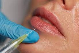 Expert Russian Lip Filler Techniques