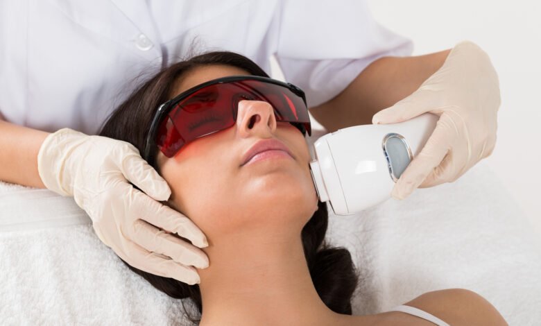 Your Guide to Flawless Skin Laser Acne Scar Treatment