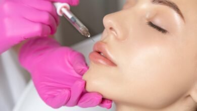 lip fillers treatment in Islamabad