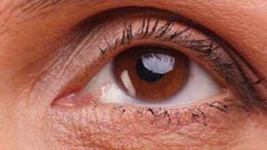 Correct Sagging Eyelids with Expert Surgery