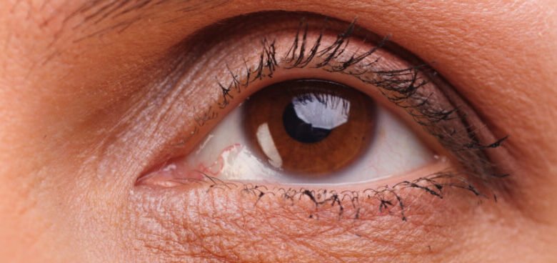 Correct Sagging Eyelids with Expert Surgery