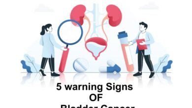 Bladder cancer is a serious condition that originates in the cells lining the bladder. It often begins in the urothelial cells