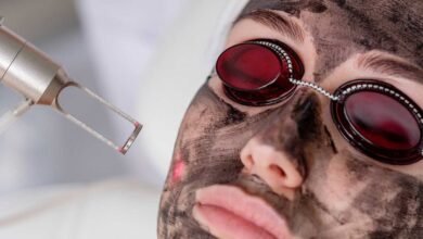 Is Laser Carbon Peel the Right Choice for Your Skin