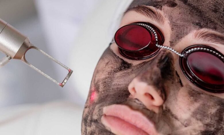 Is Laser Carbon Peel the Right Choice for Your Skin