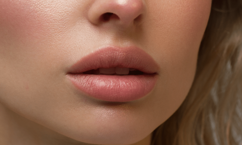 What to Expect from Russian Lip Fillers